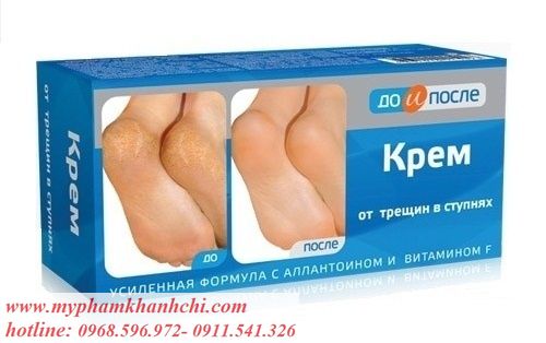 100841778-2c021fb53975d8ac838caa1fc03d967c_result