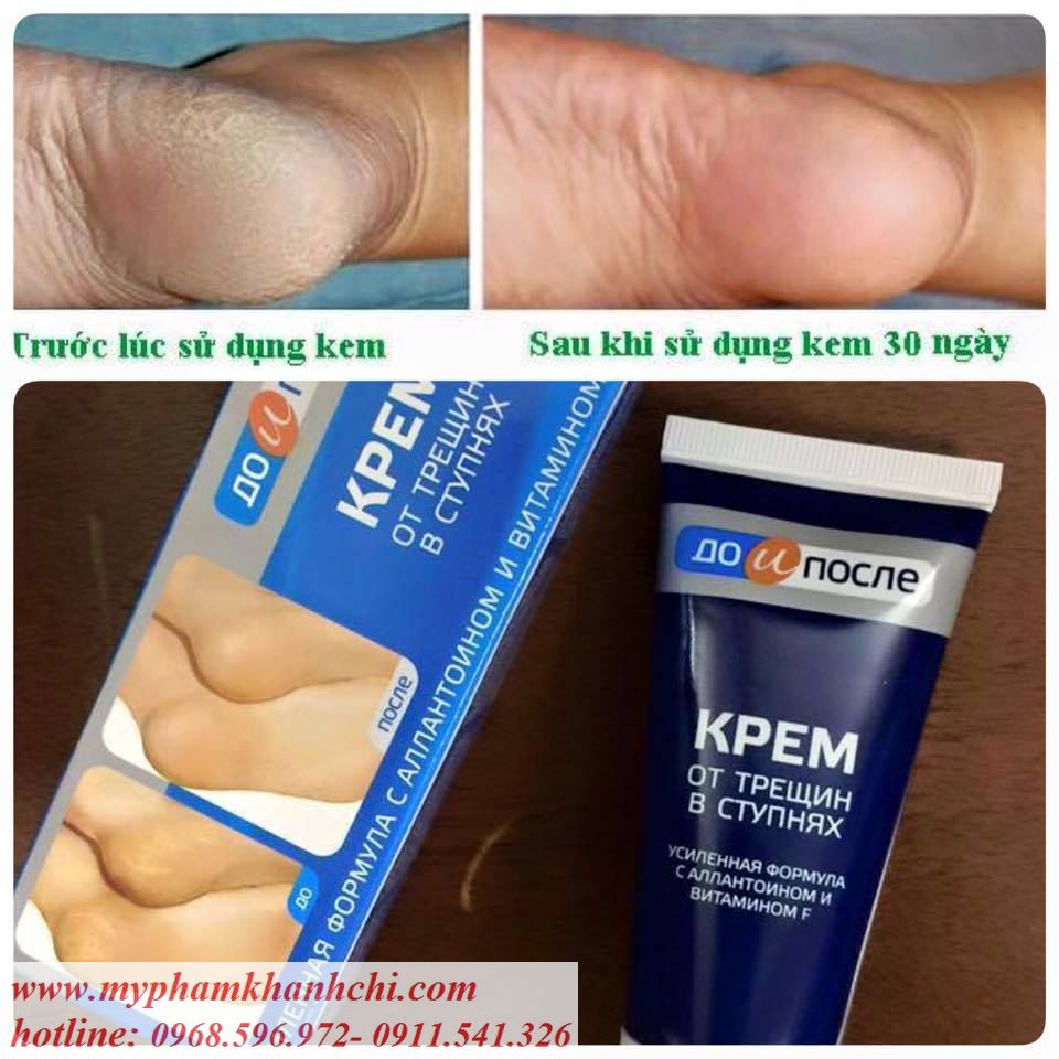 vry1479530205_result