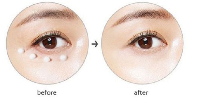 Kem-d_ng-da-m_t-AHC-The-Pure-Real-Eye-Cream-For-Face-1