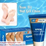 Kem-tri-nut-ne-got-chan-Apteka-cua-Nga-3_result